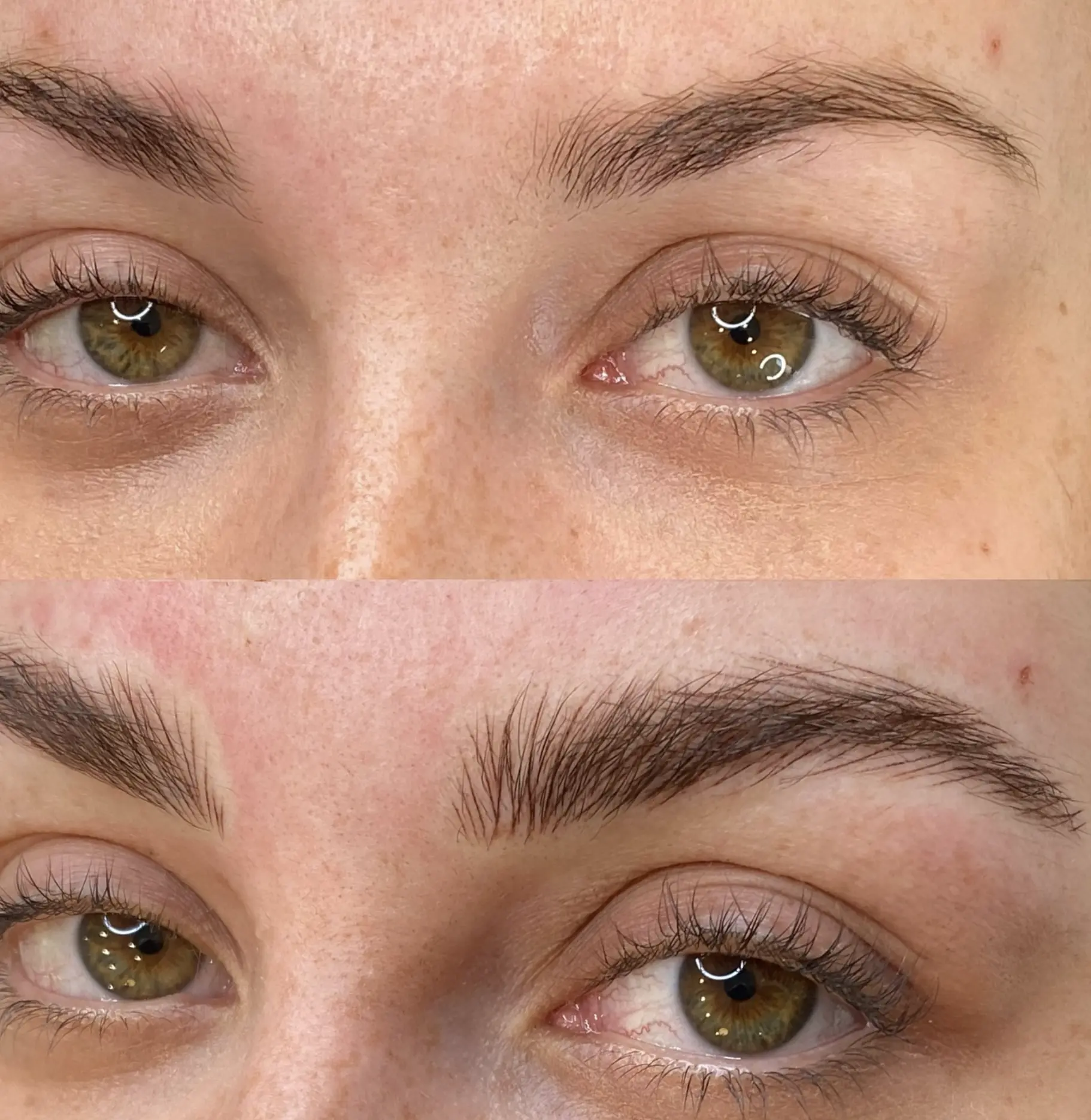 Old tattooed brows removal